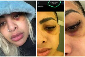 Las imágenes de Yailin La Más Viral golpeada difundidas por Santiago Matías Alofoke