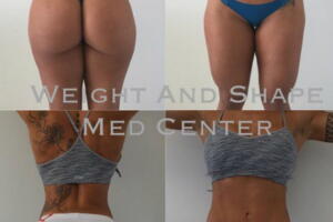 sue-lasmar-bumbum-texto.jpg