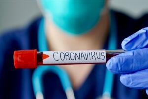 deteccion-coronavirus-covid-19-07.jpg