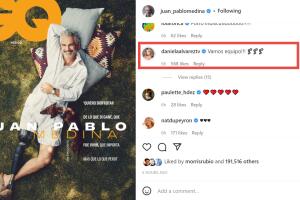 Juan Pablo Medina posa con su prótesis en la pierna y Daniella Álvarez reacciona