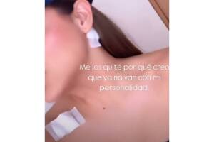 Samadhi Zendejas se sometió a un procedimiento para borrar vrios de sus tatuajes