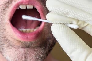 DNA test swab saliva sample