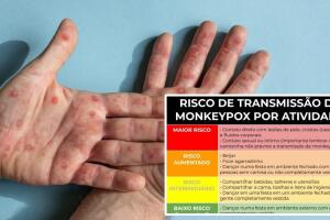 risco-monkeypox-0822.jpg