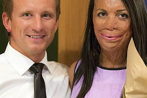 turia-pitt-4-texto.jpg