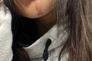 Alejandra Espinoza foto rostro ensangrentado IG.jpg