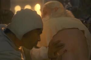 House of the Dragon heridas del rey Viserys herida y dedos (2).jpg