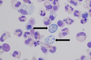 Ameba Naegleria