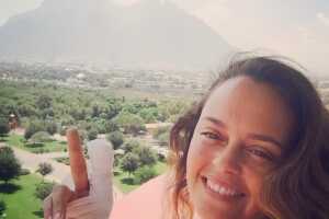 Shaila Dúrcal lesión dedo 