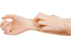 Alergia-en-las-manos-2.jpg