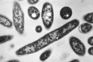  bacteria Legionella pneumophila
