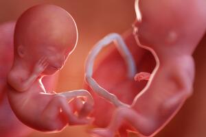gemeos-fetos-utero-0819-1400x800.jpg