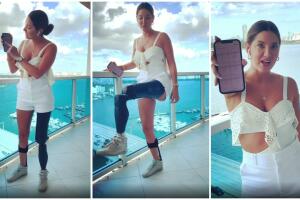 Daniella Álvarez muestra cómo funciona su prótesis mecatrónica