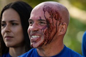 Richie fue marcado por las Amazonas