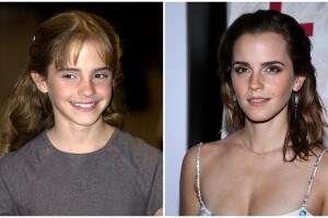 Emma Watson antes y después Univision.jpg