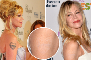 Melanie Griffith borró su tatuaje en honor a Antonio Banderas
