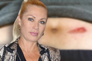 Leticia Calderón se quemó el jueves 9 de abril de 2020