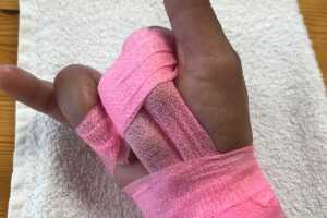 Shaila Dúrcal lesión dedo 