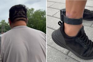 inmigrante grillete ICE infección pie diabetes monitoreo electrónico salud migrantes