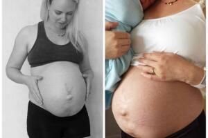barriga-depois-parto-24-horas_0.jpg