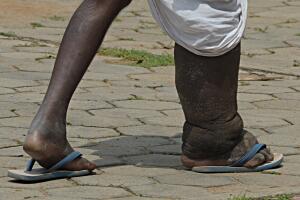 salud oms enfermedades