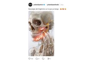 Así reveló Yolanda Andrade que fue diagnosticada con neuralgia del trigémino.