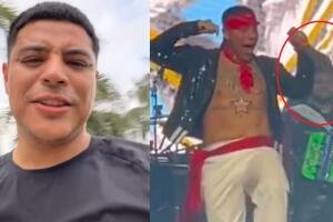 Eduin Caz sufre accidente con machetes: muestra la herida que le dejaron en pleno concierto
