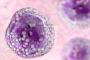 linfoma-cancer-celulas-0219-1400x800.jpg