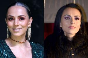 Ivonne Montero destapa daño en el rostro como Galilea Montijo: un procedimiento le “pudo provocar una parálisis”