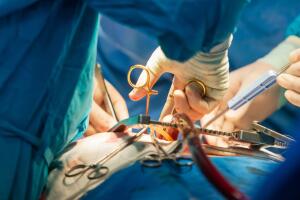 trasplante_cirugia.jpg