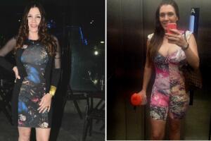 simony-antes-depois-melatonina.jpg