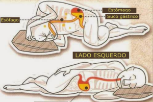 digestao-tecnica.png