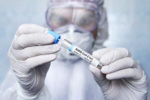 Negative test result for SARS-CoV-2, coronavirus causing CONVID-19 disease. mucosal smear. Sputum examination. a scientist in protective suit.