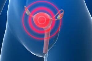 menstruacao-e-dengue-3.jpg