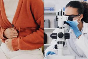 Ciclosporiasis Texas