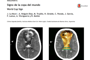 Comparativo cerebro copa mundial de futbol