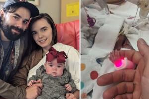 Bebé nace a los 5 meses de gestación y su historia se hace viral