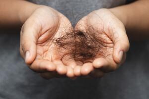 Queda de cabelo