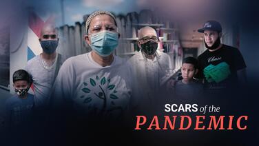 Scars of the pandemic