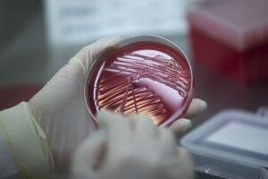 salud plomo contaminacion