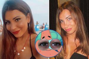 La periodista e influencer Daniela Requena se operó hace un año para cambiar, de manera definitiva, el color de sus ojos.