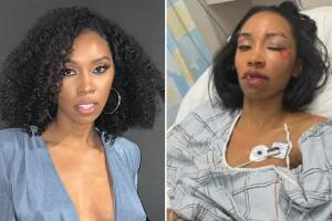 Carrie Bernans, actriz de Marvel brutalmente atropellada, "no es capaz de caminar" y claman ayuda para ella