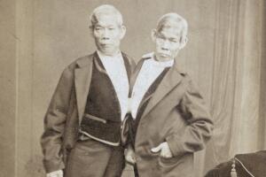 Chang And Eng Bunker murieron con horas de diferencia