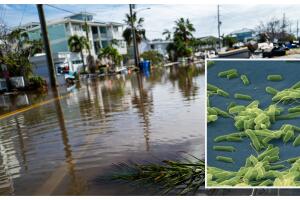 casos bacteria come carne aumentan Florida Helene Milton