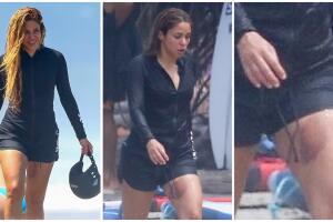 Shakira deja al descubierto tremendo moretón en las playas de Costa Rica