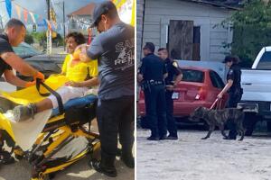 ataque perro pitbull mordidas San Antonio Texas