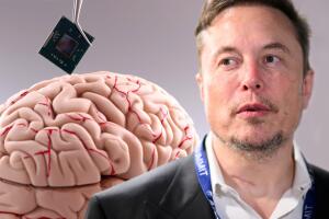 Chip cerebral de Elon Musk