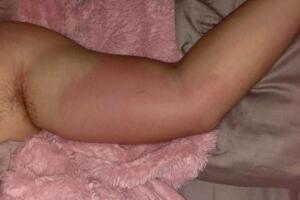 bacteria come carne/brazo chico.jpeg