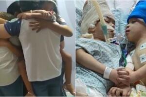 Gêmeos unidos pelo crânio são separados com sucesso