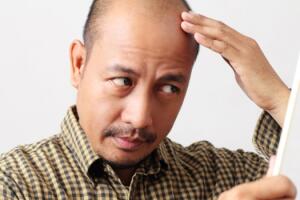 homem-careca-espelho-0716-630x350.jpg