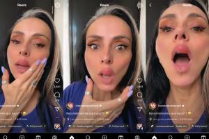 Ivonne Montero apareció con la parte superior del labio hinchado y desfigurado.